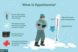 Hypothermia: Symptoms, Stages ...